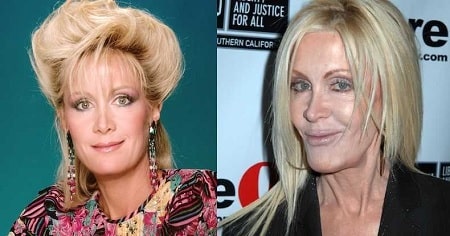 A picture of Joan Van Ark before (left) and after (right).